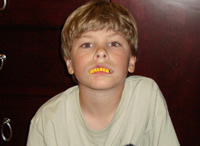 Dentist anyone?